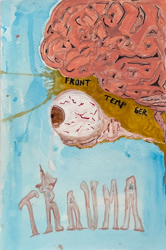 Trauma
